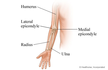 epicond-diagram